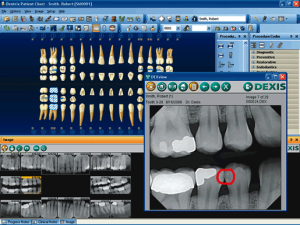 Radiographs on a computer screen